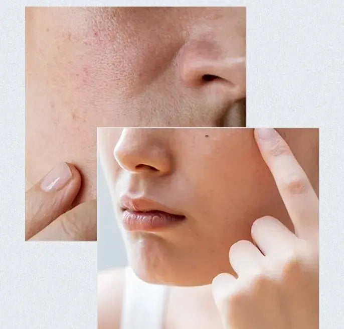Anua - Birch Moisture Boosting Serum - 30ml