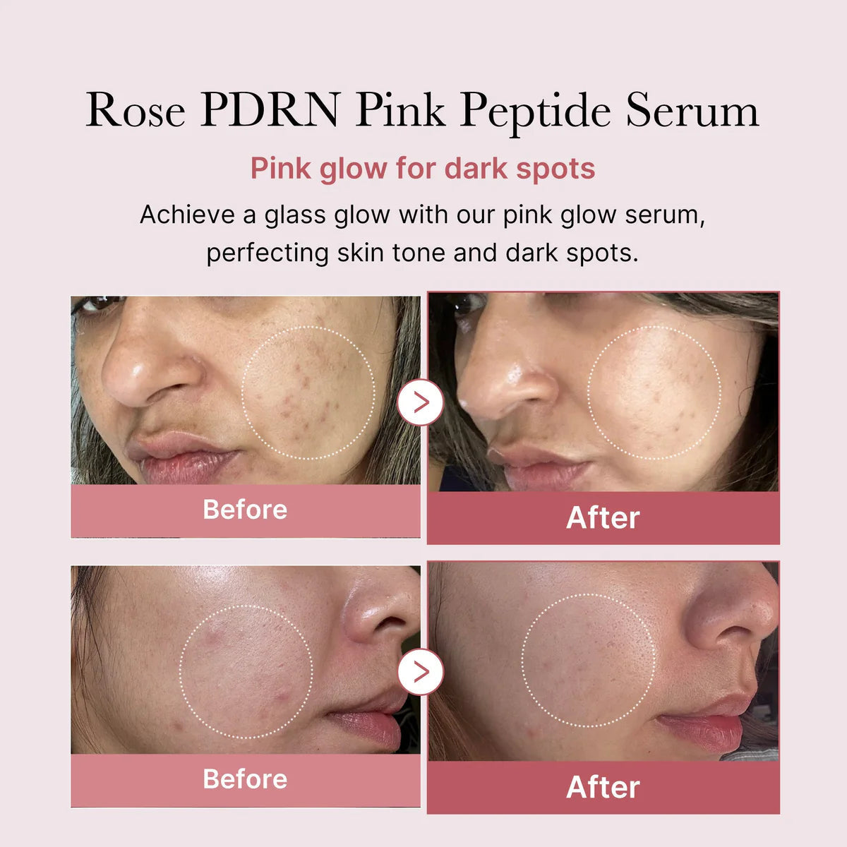 Medicube - PDRN Pink Peptide Serum 30ml