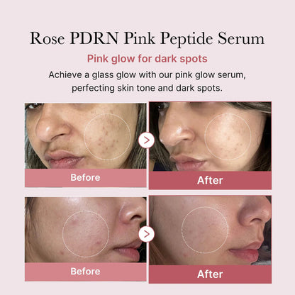 Medicube - PDRN Pink Peptide Serum 30ml